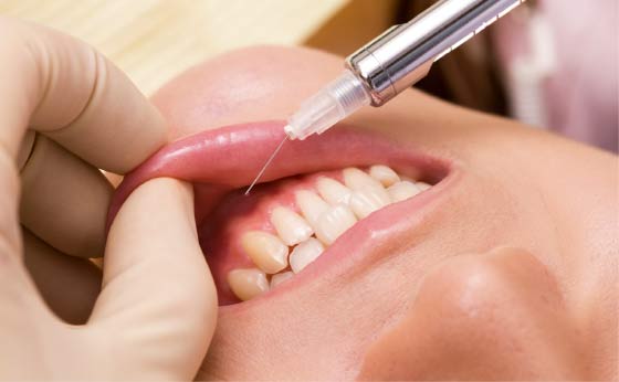 歯周病イメージ